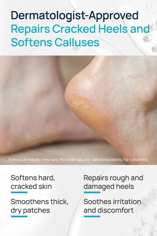 20% Urea Cracked Heel Roll-On - Image 3