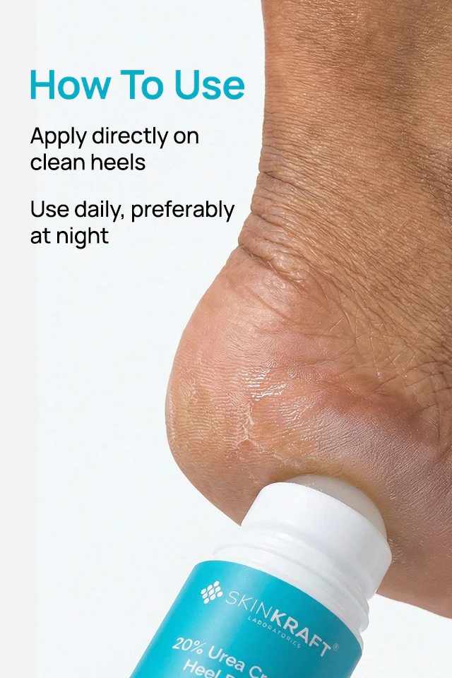 20% Urea Cracked Heel Roll-On - Image 6