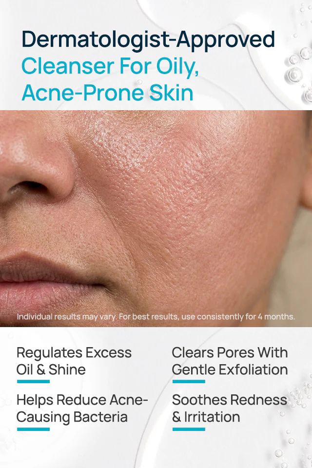 Acne Shield Facial Cleanser For Oily Skin - Image 3