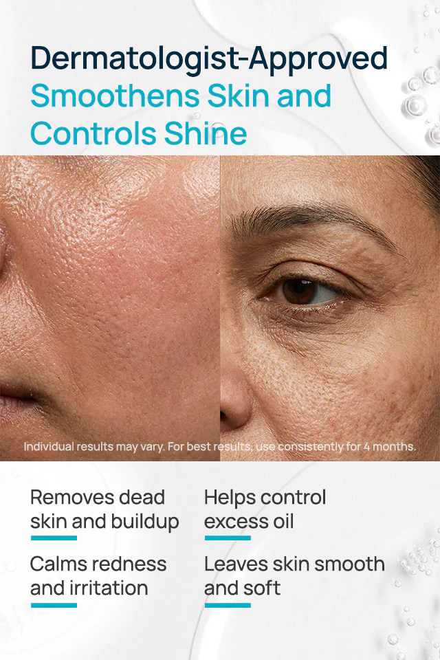 De-Grease Mattifying Face Scrub - Image 3