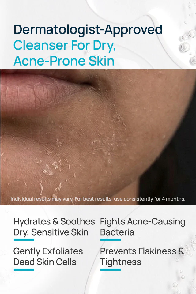 AcneShield Facial Cleanser For Dry Skin - Image 3