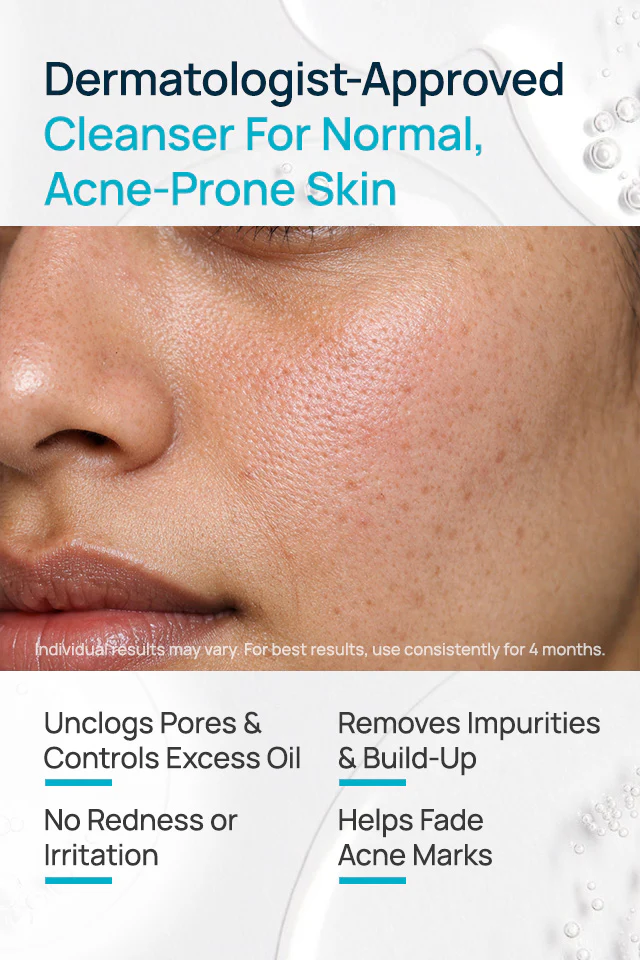 AcneShield Facial Cleanser For Normal SKin - Image 3