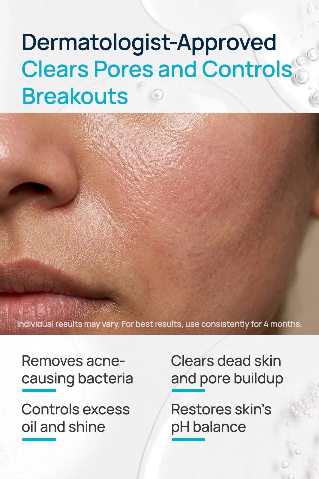 Acne Shield Facial Toner - Image 3