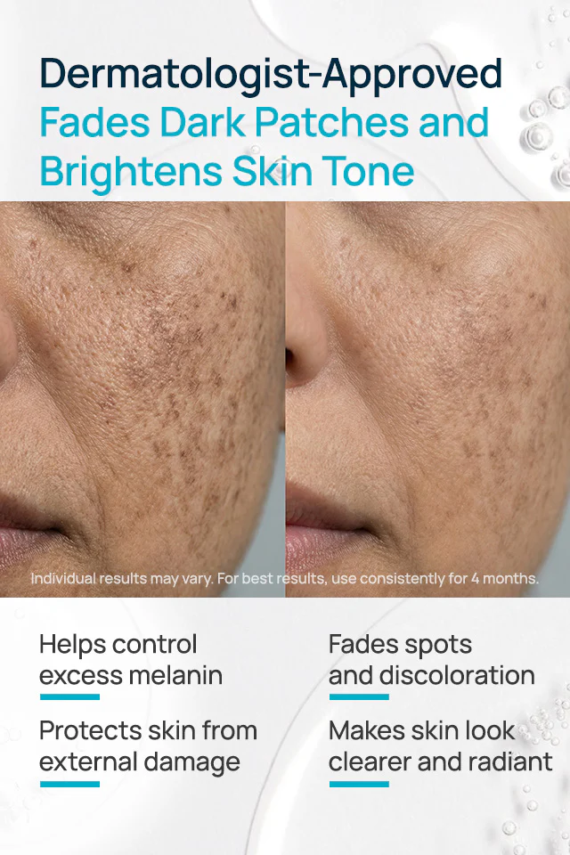 Niacinamide With Licorice Depigmentation Serum - Image 3