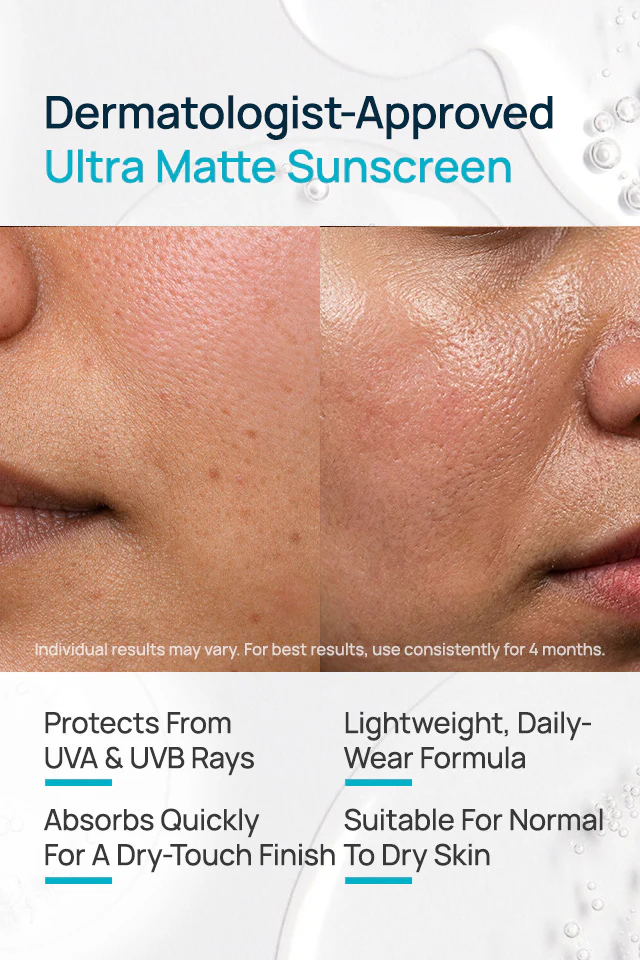 Ultra Matte Sheer Crème Gel SPF 40 PA+++ Sunscreen - Image 3